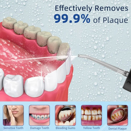 Irrigador Bucal Inalámbrico Recargable USB– Limpieza Dental